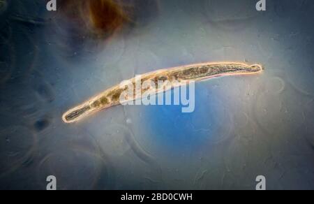 Protisti ciliati vivi di Spirostomum Foto Stock