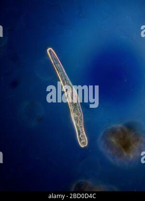 Protisti ciliati vivi di Spirostomum Foto Stock