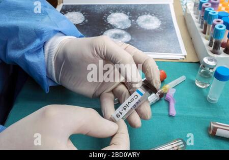 Lo scienziato esamina il campione di coronavirus in laboratorio, immagine concettuale Foto Stock