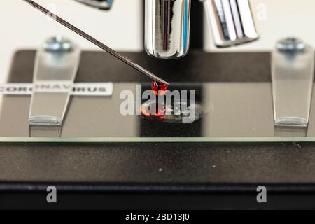 campione di sangue posizionato su un vetrino per microscopio Foto Stock