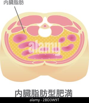 Tipo di illustrazione dell'obesità . Vista in sezione addominale (grasso viscerale). Illustrazione Vettoriale