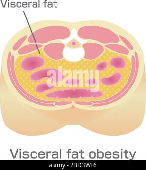 Tipo di illustrazione dell'obesità . Vista in sezione addominale (grasso viscerale). Illustrazione Vettoriale