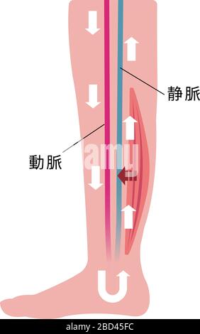 Causa di gonfiore (edema) delle gambe. Illustrazione piatta della gamba normale Illustrazione Vettoriale