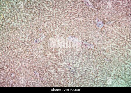 Tessuto per emosiderosi al microscopio 100x Foto Stock