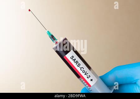 Il medico tiene la siringa con un coagulo di sangue di Coronavirus positivo. Una goccia di sangue sull'ago di una siringa. Messa a fuoco selettiva. Foto Stock