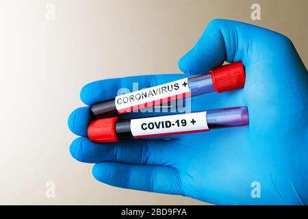 Il guanto manuale contiene la provetta con il campione di analisi del sangue positivo per il COVID-19 Foto Stock
