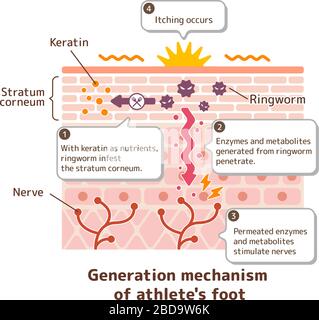 Meccanica di generazione del piede dell'atleta (ringworm) illustrazione vettoriale / con testi di spiegazione in inglese. Illustrazione Vettoriale