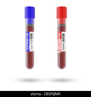Sangue e plasma in provette che sono state analizzate per la presenza di COVID-19, 2019-ncov o coronavirus per trovare un modo per fermare la pandemia. Tubo blu, risultato Negati Foto Stock