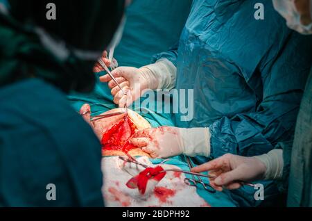 Cucitura dei tessuti addominali con punti in chirurgia isterectomica Foto Stock