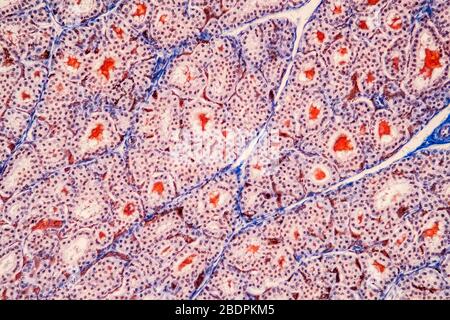 Il tessuto tiroide sotto il microscopio 200x Foto Stock