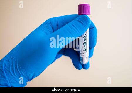 Una mano di operatore sanitario con guanto blu che contiene un tampone per provette per campioni per il test COVID-19 del coronavirus Foto Stock