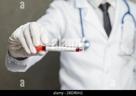 Primo piano delle mani del medico maschile asiatico. Prende sangue di coronavirus del paziente nella provetta dell'ospedale. Foto Stock