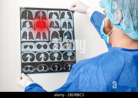 Medico chirurgo in controllo uniforme protettivo su pellicola di raggi X di scansione dei polmoni. Coronavirus Covid 19, polmonite, tubercolosi, cancro polmonare, respiratorio Foto Stock