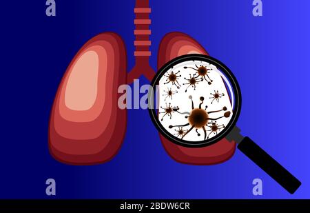 Virus e batteri infettati i polmoni umani. Malattia polmonare, Magnifier rileva virus polmonare, isolato sfondo blu - vettore Illustrazione Vettoriale