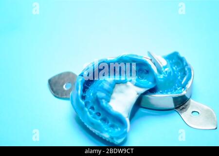Due impronte dentali su sfondo blu con spazio per le copie. Stampi dentali dalle ganasce superiore e inferiore in materiale siliconico. Foto Stock
