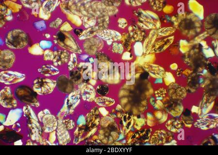 Foraminifera (LM) Foto Stock
