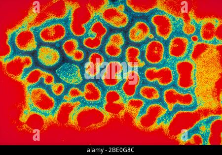 Trasmissione micrografia elettronica dell'influenza A. il virus dell'influenza A causa l'influenza negli uccelli e in alcuni mammiferi, ed è l'unica specie del virus dell'influenza A. il virus dell'influenza A è un genere della famiglia dei virus Orthomyxoviridae. Ceppi di tutti i sottotipi del virus dell'influenza A sono stati isolati dagli uccelli selvatici, sebbene la malattia sia non comune. Alcuni isolati del virus dell'influenza A causano gravi malattie sia nel pollame domestico che, raramente, nell'uomo. Occasionalmente, i virus vengono trasmessi dagli uccelli acquatici selvatici al pollame domestico, e ciò può causare un focolaio o dare origine a pandemie influenzali umane Foto Stock