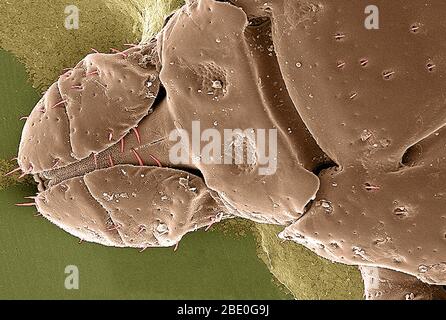 SEM con miglioramento del colore che mostra la vista dorsale di una variabilis Dermacentor. Variabilis, conosciuto anche come il tick americano del cane o il tick del legno, è una specie di tick che è conosciuto per trasportare i batteri responsabili di parecchie malattie nell'uomo, compreso la febbre macchiata e tularemia della montagna Rocky (Francisella tularensis). È uno dei segni di spunta più noti. Le malattie si diffondono quando succhia sangue dall'ospite, che potrebbe richiedere diversi giorni affinché l'ospite sperimenti alcuni sintomi. Ingrandimento: 98x. Foto Stock