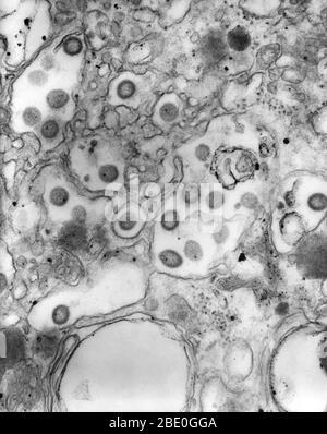 Micrografia elettronica a trasmissione colorata negativamente (TEM) di numerosi virioni del virus Ganjam in campioni di tessuto. Questo membro della famiglia Bunyaviridae è antigenicamente, strettamente correlato e una variante asiatica del virus della malattia delle pecore di Nairobi (NSDV). Sebbene non contagioso, il virus Ganjam è un arbovirus, diffuso attraverso il morso di alcuni segni di spunta, tra cui Hemaphysalis intermedia e Rhipephalus emaphysicaloides. La più grande famiglia di virus, Bunyaviridae sono virus di RNA a singolo filamento a senso negativo ((-) ssRNA), che sono diffusi attraverso il contatto con artropodi e roditori infetti. Foto Stock