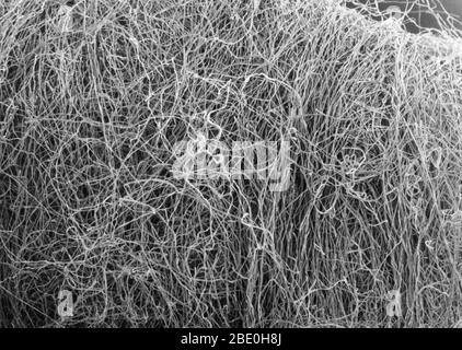 Tampone di cotone osservato sotto un microscopio elettronico a scansione. I filamenti convoluti sono le fibre di cotone che comprendono la punta morbida e assorbente del tampone. Ingrandimento: 60X a 8X10'. Foto Stock