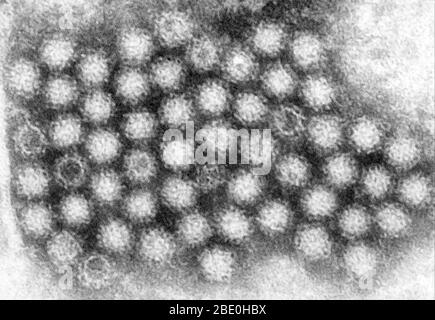 Questa micrografia elettronica a trasmissione (TEM) ha rivelato alcune delle morfologie ultrastrutturali mostrate dai virioni del norovirus, o particelle virali. I norovirus appartengono al genere Norovirus e alla famiglia Caliciviridae. Si tratta di un gruppo di virus correlati, non incapsulati, a filamento singolo, a RNA che causano gastroenterite acuta nell'uomo. Il norovirus è stato recentemente approvato come nome ufficiale del genere per il gruppo di virus provvisoriamente descritti come virus tipo Norwalk (NLV). Foto Stock