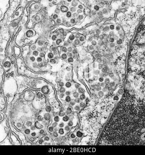Micrografia elettronica a trasmissione (TEM) di una sezione sottile di MERS-cov, che mostra le particelle sferiche e le sezioni trasversali attraverso il nucleocapside virale. Il coronavirus della sindrome respiratoria del Medio Oriente (MERS-cov) è un nuovo coronavirus (nCoV) riportato per la prima volta il 24 settembre 2012 dal virologo egiziano Dr. Ali Mohamed Zaki a Jeddah, Arabia Saudita. Ha isolato e identificato un coronavirus precedentemente sconosciuto dai polmoni di un paziente maschio di 60 anni con polmonite acuta e insufficienza renale acuta. MERS-cov è il sesto tipo di coronavirus come la SARS (ma ancora distinto da esso e dal comune-c Foto Stock