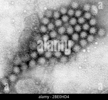 Questa micrografia elettronica a trasmissione (TEM) ha rivelato alcune delle morfologie ultrastrutturali mostrate dai virioni del norovirus, o particelle virali. I norovirus appartengono al genere Norovirus e alla famiglia Caliciviridae. Si tratta di un gruppo di virus correlati, non incapsulati, a filamento singolo, a RNA che causano gastroenterite acuta nell'uomo. Il norovirus è stato recentemente approvato come nome ufficiale del genere per il gruppo di virus provvisoriamente descritti come virus tipo Norwalk (NLV). Foto Stock