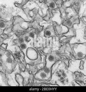 Trasmissione della micrografia elettronica (TEM) del virus Zika, un membro della famiglia Flaviviridae. Le particelle virali hanno un diametro di 40 nm, con un involucro esterno e un nucleo denso interno. Il virus Zika è diffuso alle persone attraverso le punture di zanzara. I sintomi più comuni della malattia del virus Zika sono febbre, eruzione cutanea, vernice articolare e congiuntivite (occhi rossi). La malattia è solitamente lieve, con sintomi che durano da diversi giorni a una settimana. La malattia grave che richiede ospedalizzazione è non comune. Foto Stock