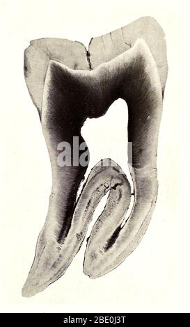 Sezione verticale del dente umano. Ingrandimento: 8x. Fotomicrografia realizzata da Arthur e Smith nei primi anni del 1900, utilizzando un microscopio e una macchina fotografica combinati. Nel 1904, la Royal Society di Londra espone al pubblico una serie di fotomicrografie di Smith. Sono stati successivamente pubblicati nel 1909 in un libro intitolato 'natura attraverso microscopio & fotocamera.' Sono stati i primi esempi di fotomicroscopia che molti avevano mai visto. Foto Stock