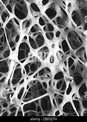 Micrografia elettronica a scansione (SEM) dell'osso spongioso della shin umana. Il tessuto osseo è compatto o tumoso. L'osso compatto di solito costituisce l'esterno dell'osso, mentre l'osso spongioso si trova all'interno. L'osso tumultuoso è caratterizzato da una disposizione a nido d'ape di trabecole. Queste strutture aiutano a fornire sostegno e forza. Gli spazi all'interno di questo tessuto contengono normalmente midollo osseo, una sostanza che forma sangue. Foto Stock