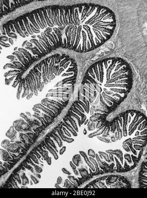 Villi intestinali con capillari. I villi sono sporgenze simili a dita dal rivestimento interno dell'intestino tenue che servono ad aumentare l'area superficiale disponibile per l'assorbimento di nutrienti dal cibo. Ogni villus ha uno strato esterno che circonda i vasi sanguigni che trasportano le sostanze nutrienti nel flusso sanguigno. Foto Stock