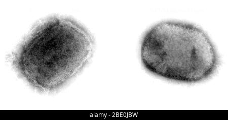 Micrografia a trasmissione a colorazione negativa (TEM) che dimostra il virus monkeypox a forma di mattone da una coltura cellulare. Il virione capsulare superficiale penetrato dalla macchia presente come un nucleo denso e definito in modo netto circondato da diverse zone laminate di densità differenti. Il virus Monkeypox (MPV) è un DNA a doppio filamento, un virus zoonotico e una specie del genere Orthopoxvirus della famiglia Poxviridae. È uno degli ortopossvirus umani che include virus di variola (VARV), cowpox (CPX) e vaiolo vaccino (VACV). Ma non è un antenato diretto, né un discendente diretto del virus variola w Foto Stock