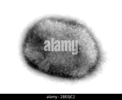 Micrografia a trasmissione a colorazione negativa (TEM) che dimostra il virus monkeypox a forma di mattone da una coltura cellulare. Il virione di gelso superficiale è ricoperto da filamenti corti e sviati. Il virus Monkeypox (MPV) è un DNA a doppio filamento, un virus zoonotico e una specie del genere Orthopoxvirus della famiglia Poxviridae. È uno degli ortopossvirus umani che include virus di variola (VARV), cowpox (CPX) e vaiolo vaccino (VACV). Ma non è un antenato diretto, né un discendente diretto del virus variola che causa il vaiolo. Il virus del monkeypox causa una malattia simile alla sma Foto Stock