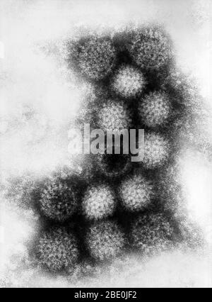 La micrografia elettronica a trasmissione (TEM) rivela alcuni dei dettagli morfologici visualizzati dal ceppo Irituia del virus Changuinola, un membro del genere Orbivirus, che è uno dei nove generi della famiglia di virus nota come Reoviridae. Il virus Changuinola abita Panama e il Nord America del Sud. Il virione di Irituia, è costituito da un capside, che non è avvolto, e che è di forma sferica, 60 nm di diametro. Il nucleo è costituito da dieci segmenti di RNA a doppio filamento. Il virus dell'irituria è stato classificato come patogeno di biosicurezza di livello 2. Come arbovirus, il virus Changuinola è s. Foto Stock