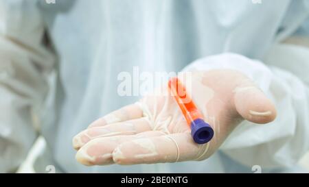 Medico con tuta bioprotettiva bianca che tiene nel palmo della mano 1 provetta con campione di sangue in primo piano e fissandola con attenzione su chi Foto Stock