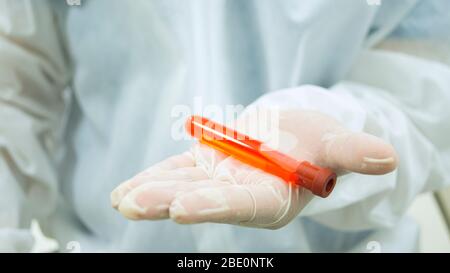 Medico con tuta bioprotettiva bianca che tiene nel palmo della mano 1 provetta con campione di sangue in primo piano e fissandola con attenzione su chi Foto Stock