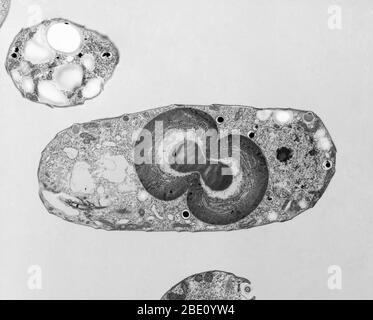 Alghe verdi blu, TEM. Foto Stock