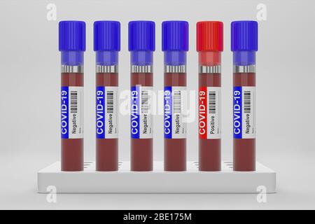 Sangue e plasma in provette che sono state analizzate per la presenza di COVID-19, 2019-ncov o coronavirus per trovare un modo per fermare la pandemia. Tubo blu, risultato Negati Foto Stock