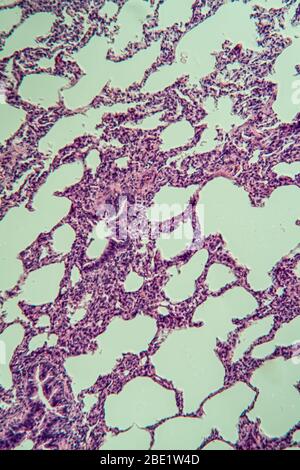 Polmoni al microscopio 100x Foto Stock