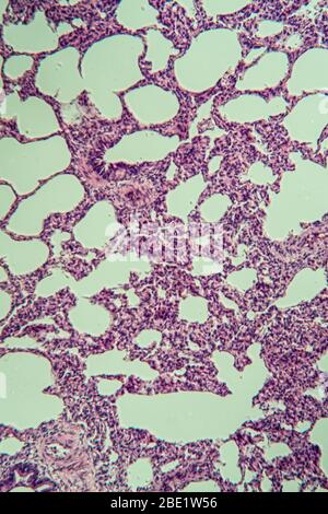 Polmoni al microscopio 100x Foto Stock