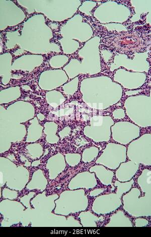 Polmoni al microscopio 100x Foto Stock