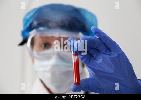 Un'infermiera tiene una provetta con il sangue in mano. Test di laboratorio per la determinazione del coronavirus. Il medico esegue un test di infezione. Concetto Foto Stock