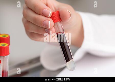 Il medico preleva la provetta di campione di sangue dal vassoio sul tavolo. Foto Stock