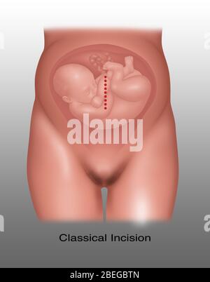 Incisione classica Cesareo, illustrazione Foto Stock