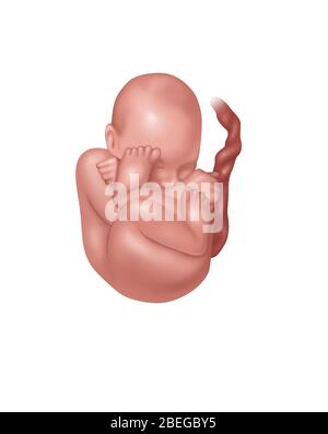 Feto in posizione Breech, illustrazione Foto Stock