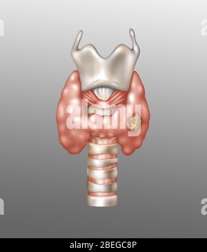 Cancro della tiroide, illustrazione Foto Stock