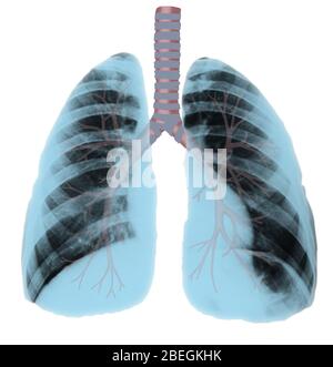 Polmoni normali Foto Stock