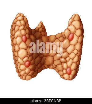 Paratiroide nella ghiandola tiroidea Foto Stock