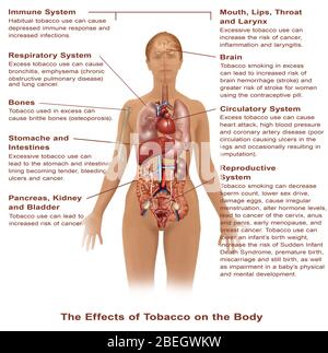 Effetti dell'uso del tabacco Foto Stock