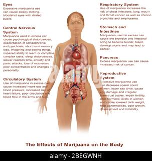 Effetti dell'uso di Marijuana Foto Stock